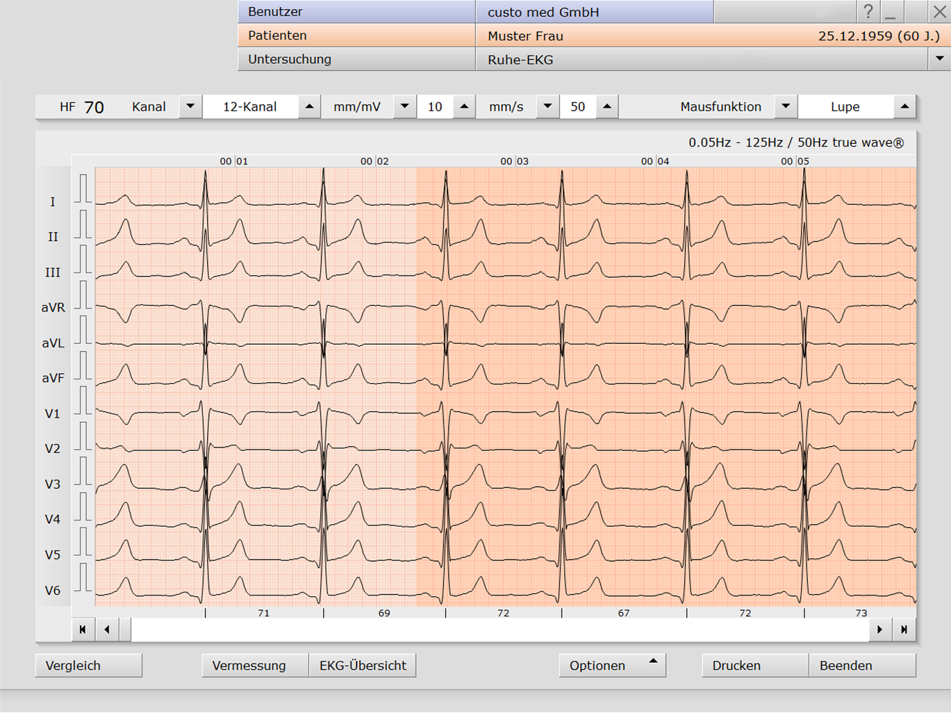 Ruhe-EKG in der custo diagnostic
