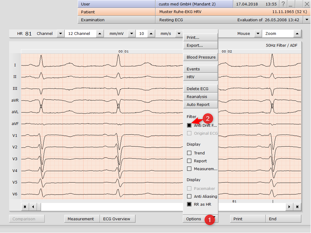 custo diagnostic 4.x > PDF Export with AD Filter > image2018-4-17_13-56-46.png