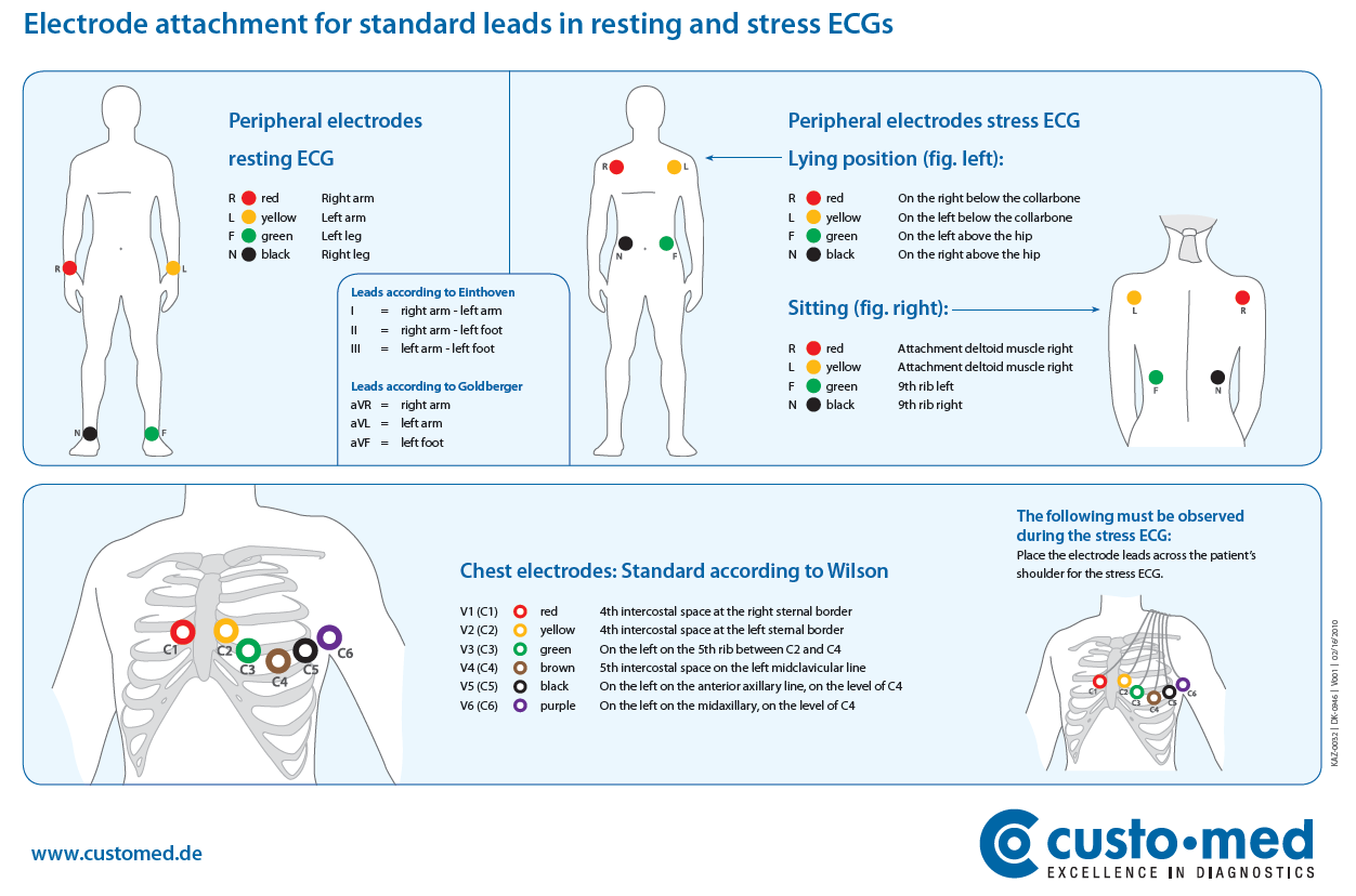 Hardware > How to prevent bad ECG > image2020-11-12_11-20-47.png
