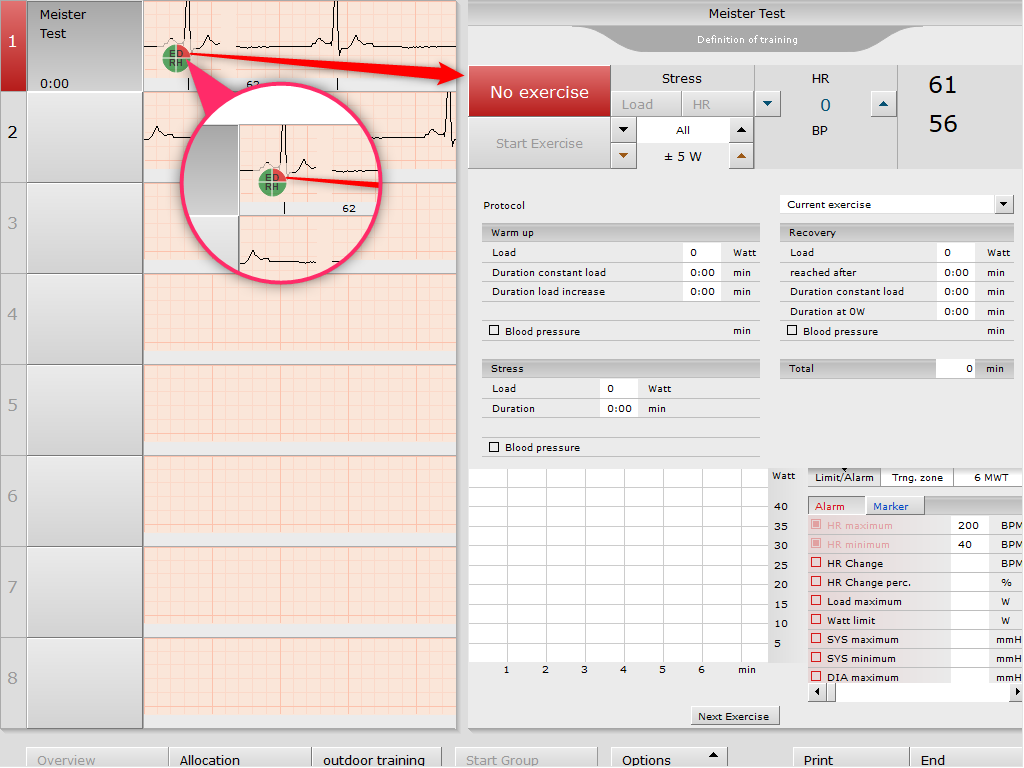 custo diagnostic 4.x > Quickstart Rehab Page Trainings Place and automatic Training Start. > image2018-2-6_16-19-50.png