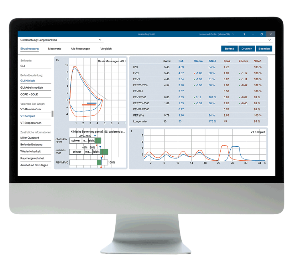 Bildschirm, der das Software-Modul custo diagnostic vit für Spirometrie in der custo diagnostic client-Version für macOs zeigt