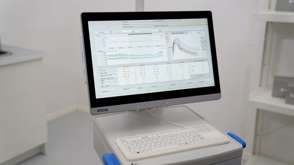 Bildschirm in Praxisumgebung, geöffnet ist Software custo diagnostic ergo von custo med mit den Ergebnissen einer Langzeit-Blutdruck-Messung