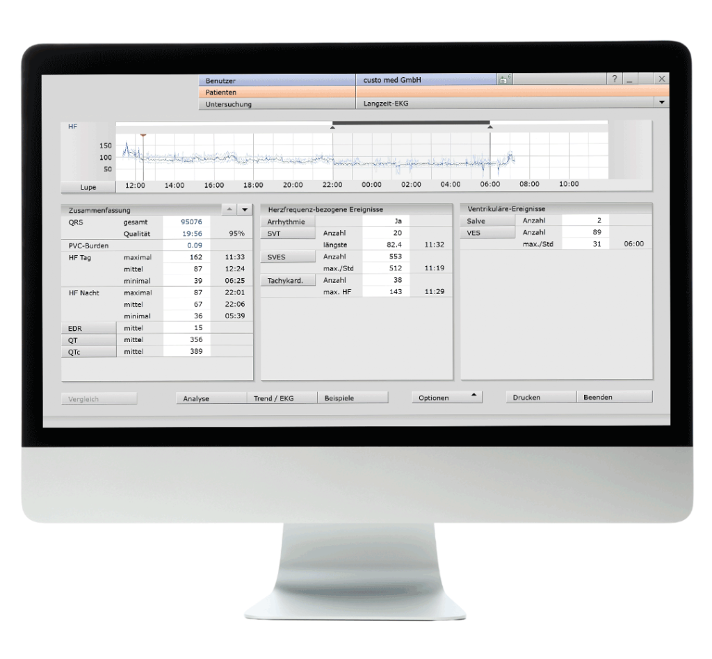 Bildschirm der eine Übersicht des Software-Moduls custo diagnostic tera von custo med zeigt