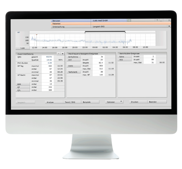 Bildschirm der eine Übersicht des Software-Moduls custo diagnostic tera von custo med zeigt