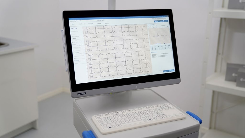 Bildschirm in Praxisumgebung, geöffnet ist Software custo diagnostic cardio von custo med mit den Ergebnissen eines Ruhe-EKGs