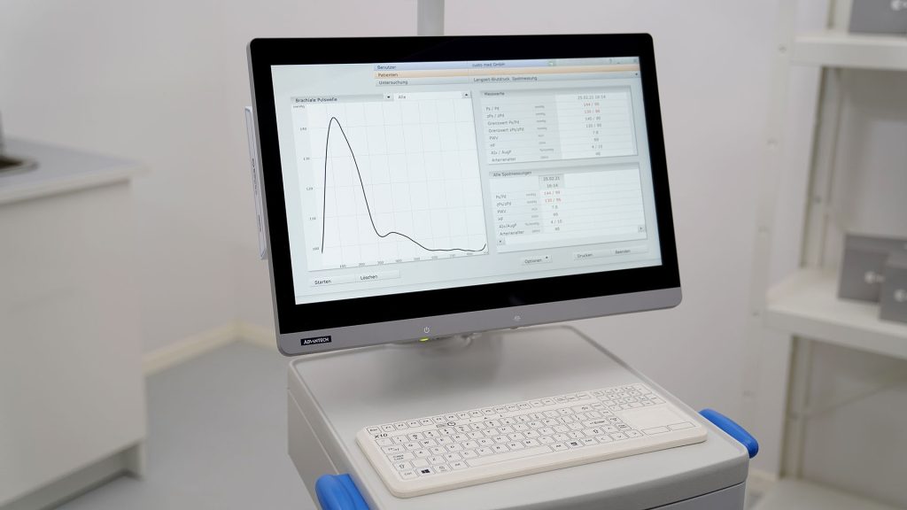 Bildschirm in Praxisumgebung, geöffnet ist Software custo diagnostic ergo von custo med mit den Ergebnissen einer Spotmessung einer Langzeit-Blutdruck-Messung