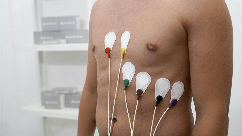 Oberkörper, an dem die Elektroden C1-C6 mit Klebeelektroden custo wing angebracht sind
