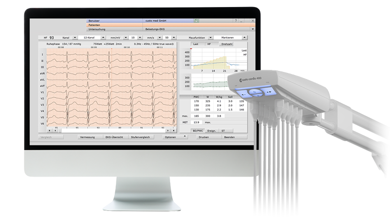 Bildschirm auf dem Software custo diagnostic ergo für Belastungs-EKG angezeigt wird, daneben custo cardio 400