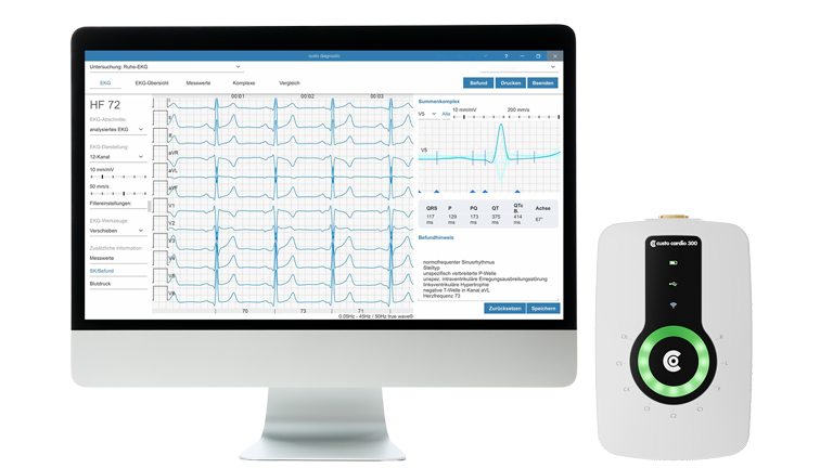 Bildschirm auf dem Software custo diagnostic cardio für Ruhe-EKG angezeigt wird, daneben custo cardio 300
