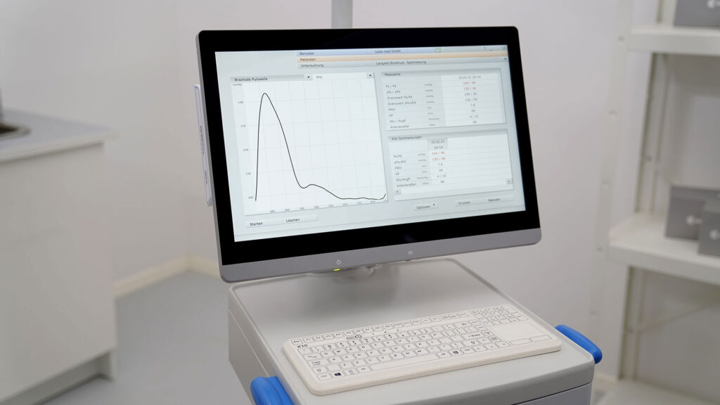 Bildschirm in Praxisumgebung, geöffnet ist Software custo diagnostic ergo von custo med mit den Ergebnissen einer Spotmessung einer Langzeit-Blutdruck-Messung