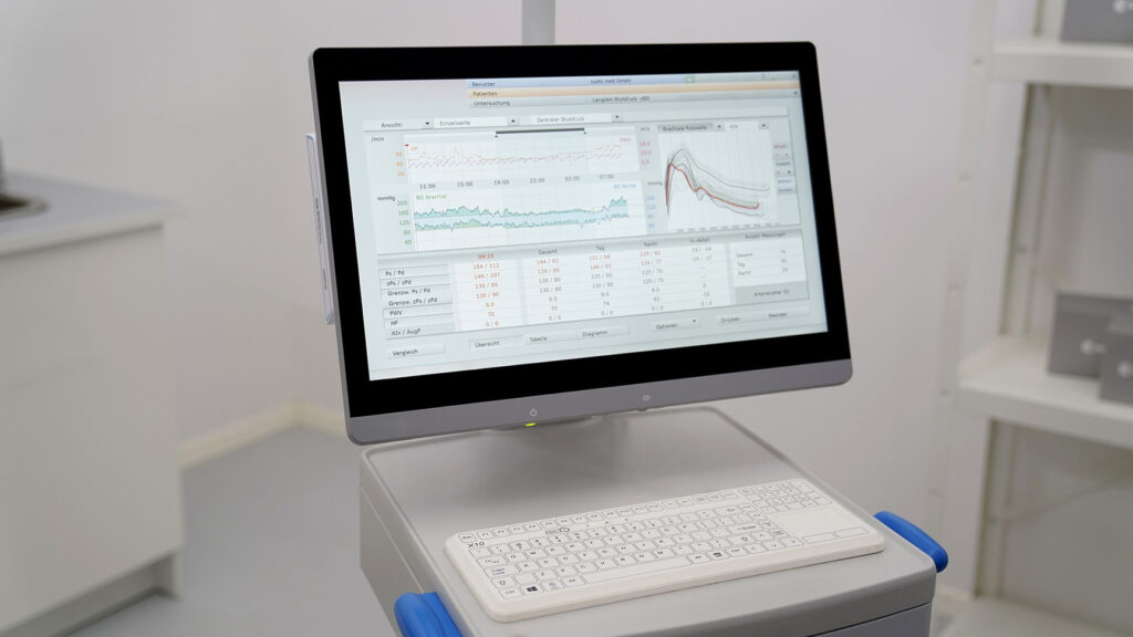 Bildschirm in Praxisumgebung, geöffnet ist Software custo diagnostic ergo von custo med mit den Ergebnissen einer Langzeit-Blutdruck-Messung