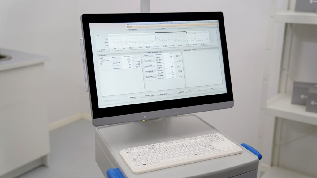 Bildschirm in Praxisumgebung, geöffnet ist Software custo diagnostic tera von custo med mit den Ergebnissen eines Langzeit-EKGs