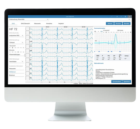 Bildschirm mit der geöffneten Software custo diagnostic screen in der custo diagnositc client-Version