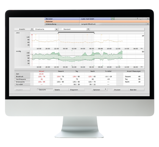 Bildschirm mit der geöffneten Software custo diagnostic screen