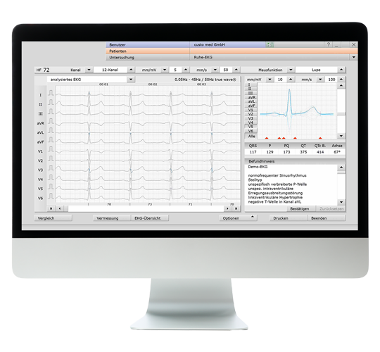 ildschirm mit der geöffneten Software custo diagnostic cardio