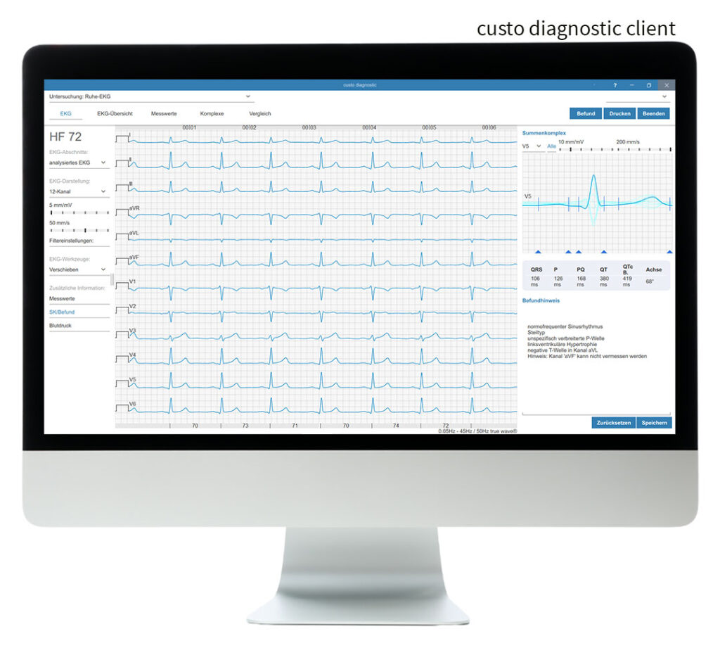 Bildschirm mit der geöffneten Software custo diagnostic cardio in der custo diagnostic client-Version. Über dem Bildschirm steht "custo diagnostic client"