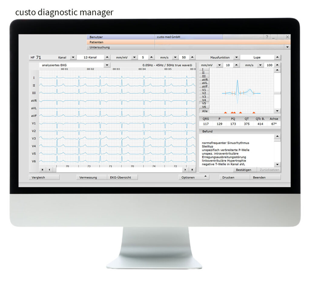 Bildschirm mit der geöffneten Software custo diagnostic cardio in der custo diagnostic manager-Version. Über dem Bildschirm steht "custo diagnostic manager"