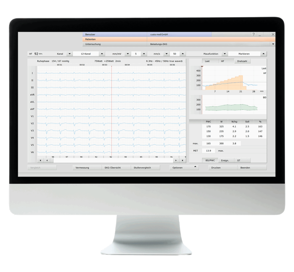 Bildschirm mit der geöffneten Software custo diagnostic ergo in der custo diagnostic manager-Version.