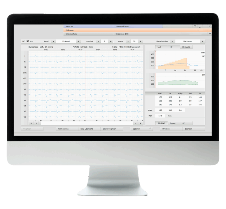 Bildschirm mit der geöffneten Software custo diagnostic ergo in der custo diagnostic manager-Version.