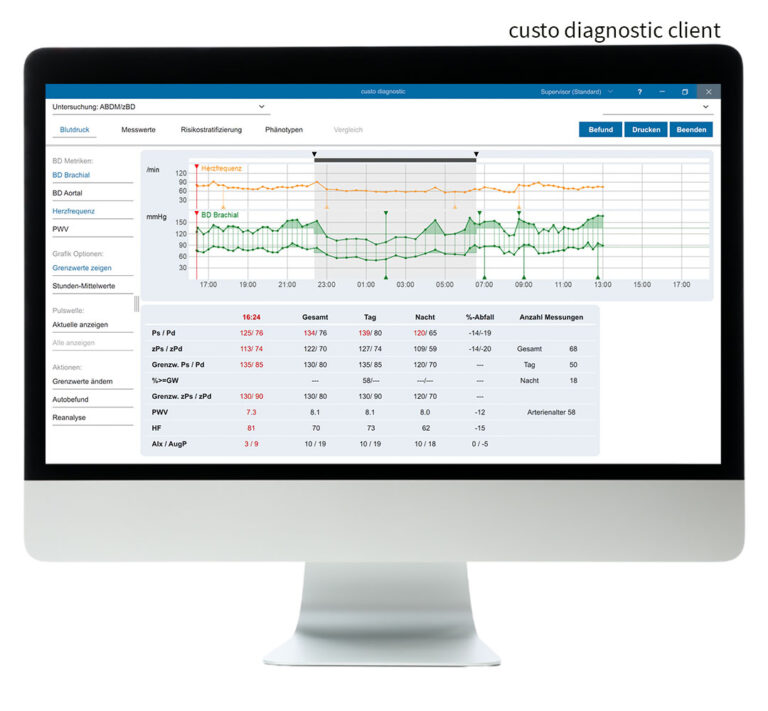 Bildschirm mit der geöffneten Software custo diagnostic screen in der custo diagnostic client-Version. Über dem Bildschirm steht "custo diagnostic client"