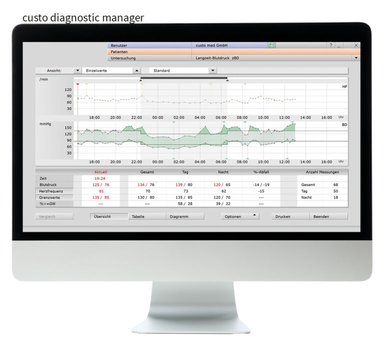 Bildschirm mit der geöffneten Software custo diagnostic screen in der custo diagnostic manager-Version. Über dem Bildschirm steht "custo diagnostic manager"
