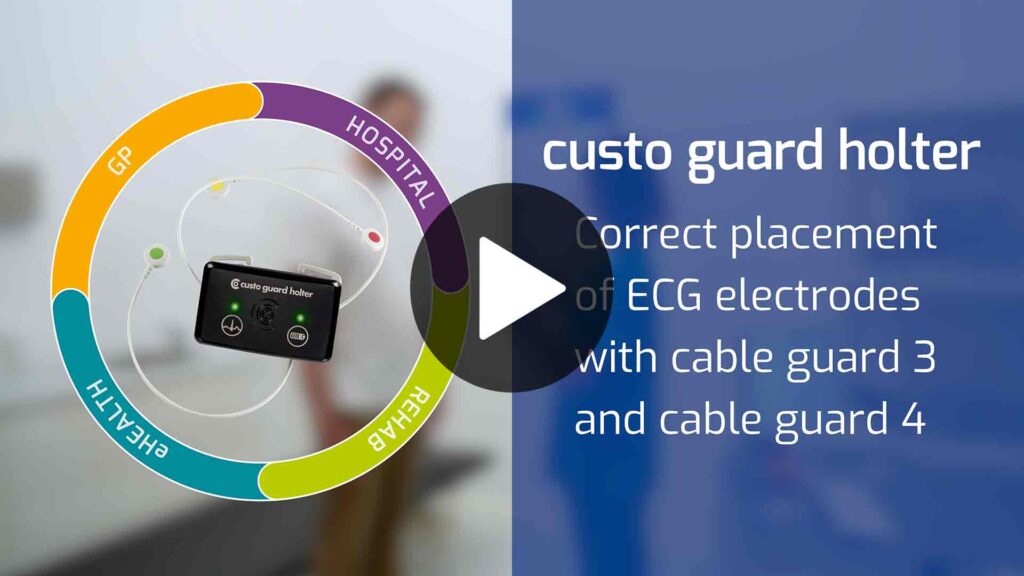 User video "Correct placement ECG electrodes ECG cable guard 3 4". Click opens the Video.