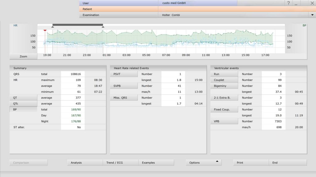 Pantalla que muestra el software custo diagnostic tera de custo med, con los resultados de una medición combinada de Holter ECG y MAPA.